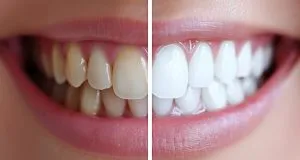 Estetica dental
